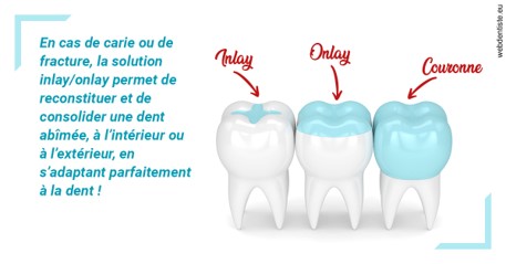 https://dr-maarek-jonathan.chirurgiens-dentistes.fr/L'INLAY ou l'ONLAY