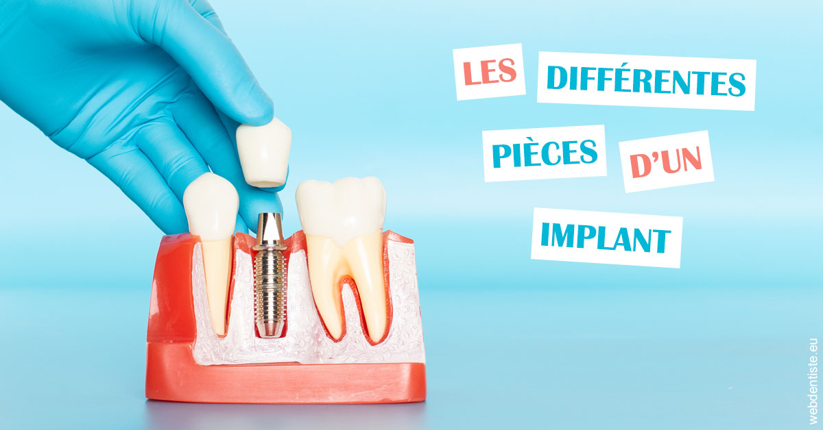 https://dr-maarek-jonathan.chirurgiens-dentistes.fr/Les différentes pièces d’un implant 2