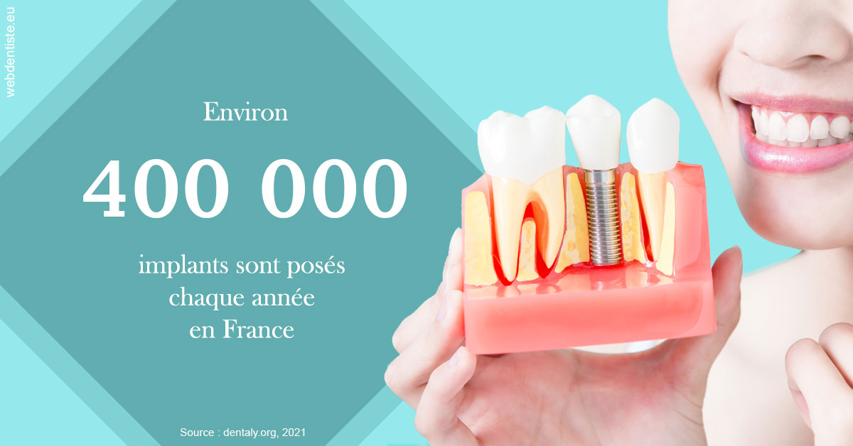 https://dr-maarek-jonathan.chirurgiens-dentistes.fr/Pose d'implants en France 2